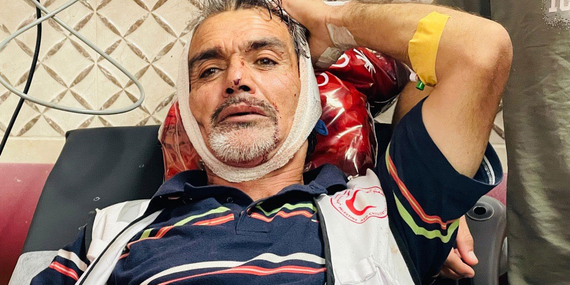 מתנדב של אגודת הסהר האדום הפלסטינית מקבל טיפול רפואי לאחר שנפצע מידי מתנחלים שתקפו מוסקי זיתים בביתא, נפת שכם, 8 בנובמבר 2025. צילום: העיתונאי עבדאללה בחש.