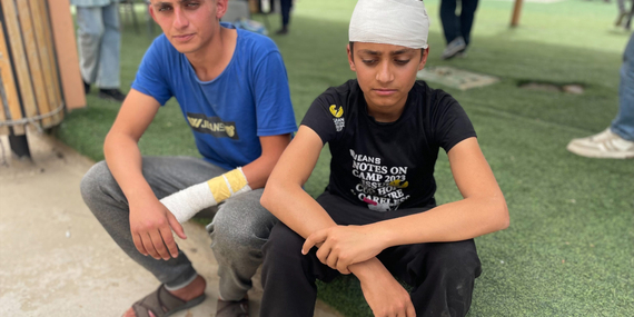 שני אחים שנפצעו מידי מתנחלים שפרצו לאוהליהם בג'ינבה, מסאפר יטא (נפת חברון) ב-28 במרס 2025. צילום: משרד האו"ם לתיאום עניינים הומניטריים