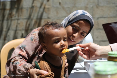 Providing nutrition treatment to a child in Gaza. Photo by UNICEF/El Baba
